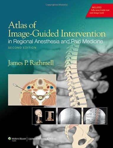 Atlas of Image Guided Intervention in Regional Anesthesia and Pain Medicine 2nd edition