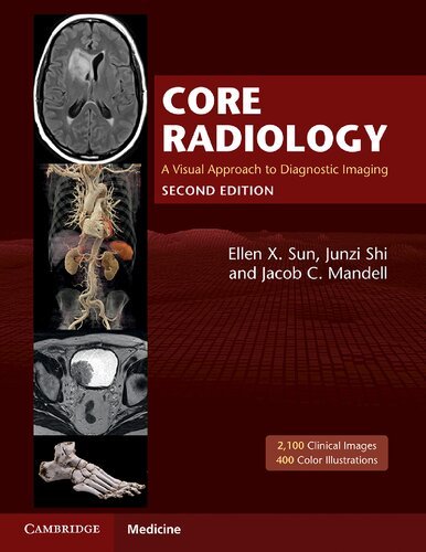 Core Radiology A Visual Approach to Diagnostic Imaging 2nd Edition