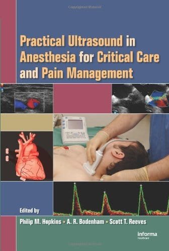 Practical Ultrasound in Anesthesia for Critical Care and Pain Management 1st edition