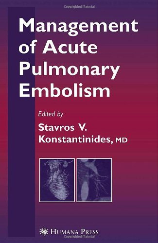 Management of Acute Pulmonary Embolism