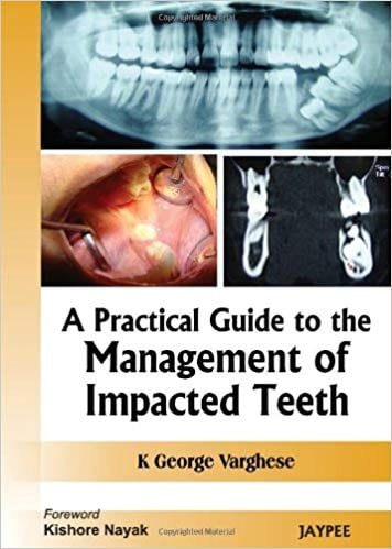 A Practical Guide to the Management of Impacted Teeth 1st edition