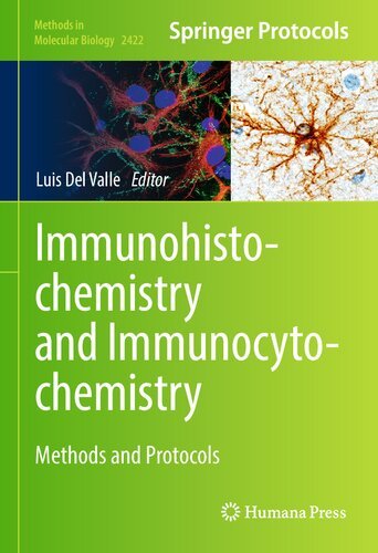 Immunohistochemistry and Immunocytochemistry: Methods and Protocols