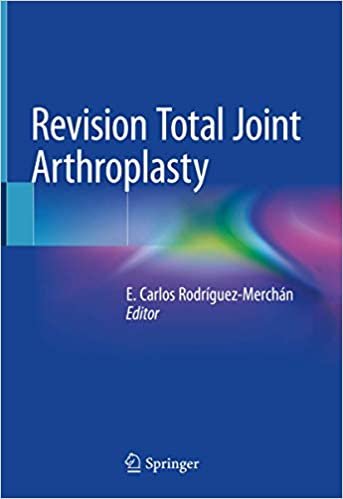 Revision Total Joint Arthroplasty