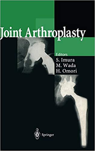 Joint Arthroplasty