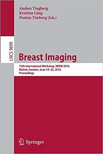 Breast Imaging 13th International Workshop