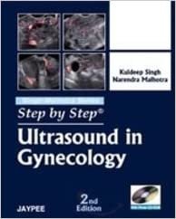 Step by Step Ultrasound in Gynecology 2nd Edition