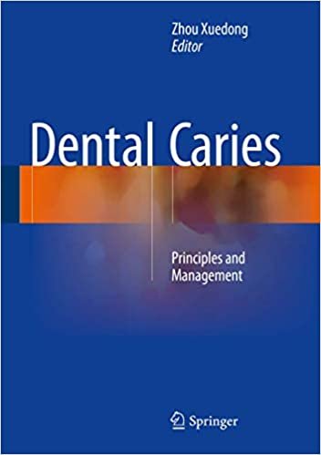 Dental Caries Principles and Management