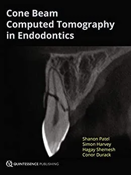 Cone Beam Computed Tomography in Endodontics 1st edition