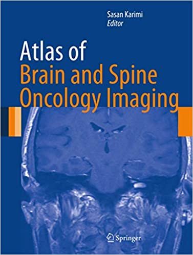 Atlas of Brain and Spine Oncology Imaging