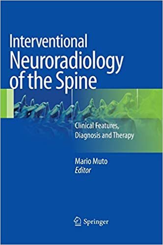 Interventional Neuroradiology of the Spine Clinical Features Diagnosis and Therapy
