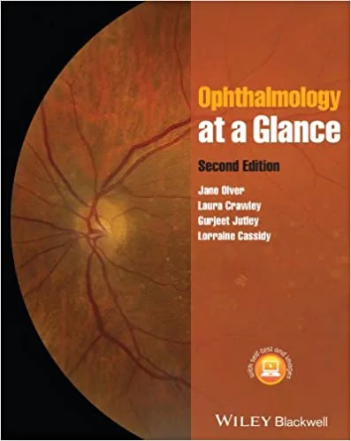 Ophthalmology At A Glance 2nd edition