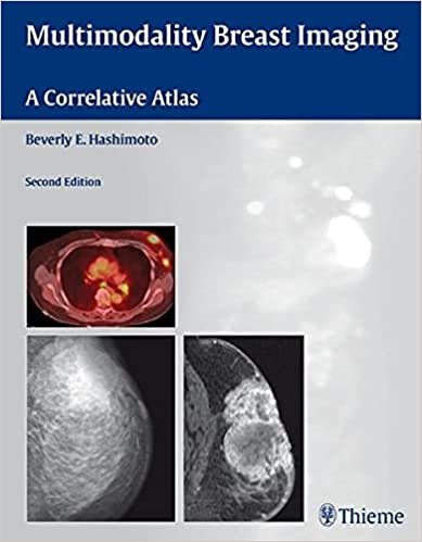 Multimodality Breast Imaging A Correlative Atlas 2nd Ed
