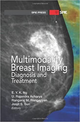 Multimodality Breast Imaging Diagnosis and Treatment