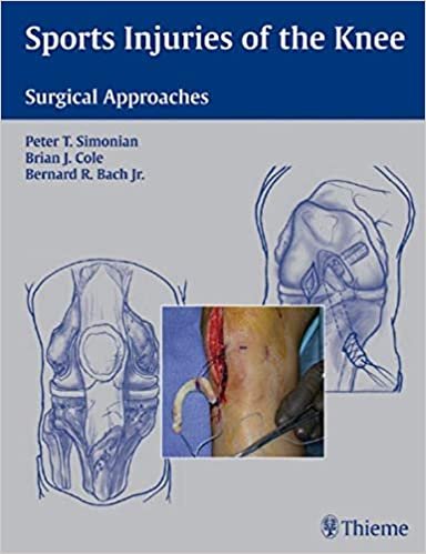 Sports Injuries of the Knee Surgical Approaches