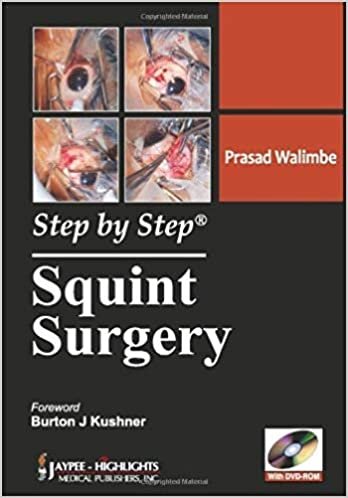 Step by Step Squint Surgery