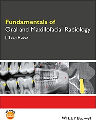Fundamentals Of Oral And Maxillofacial Radiology 1st edition