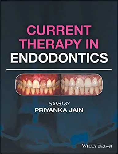 Current Therapy in Endodontics 1st edition