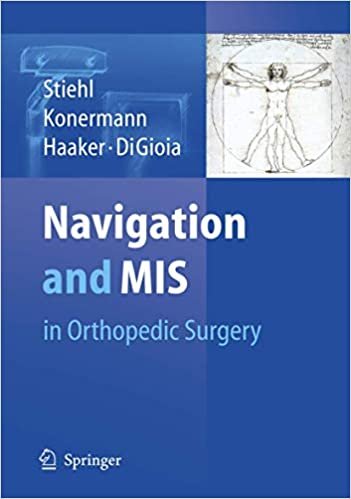 Navigation and MIS in Orthopedic Surgery
