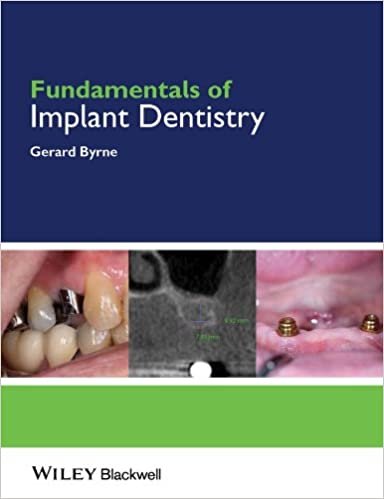 Fundamentals Of Implant Dentistry 1st edition