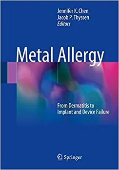 Metal Allergy From Dermatitis to Implant and Device Failure 1st edition