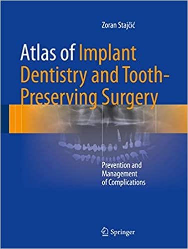 Atlas of Implant Dentistry and Tooth Preserving Surgery Prevention and Management of Complications 1st edition
