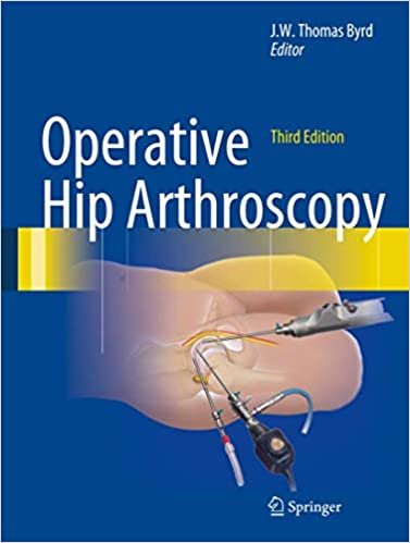 Operative Hip Arthroscopy 3rd Ed