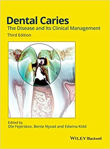 Dental Caries The Disease And its Clinical Management 3rd Edition