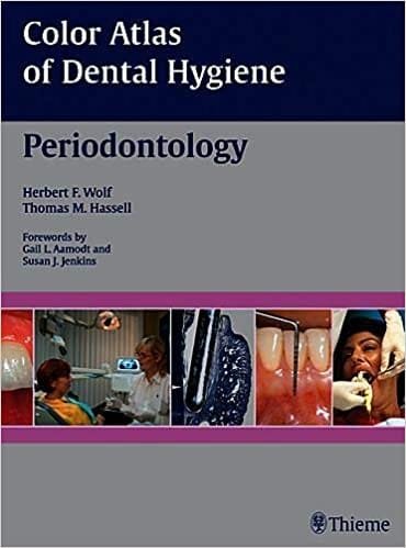 Color Atlas of Dental Hygiene Periodontology 1st edition