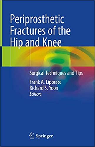 Periprosthetic Fractures of the Hip and Knee Surgical Techniques and Tips