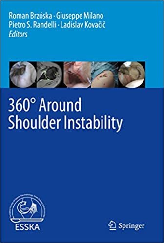 360° Around Shoulder Instability