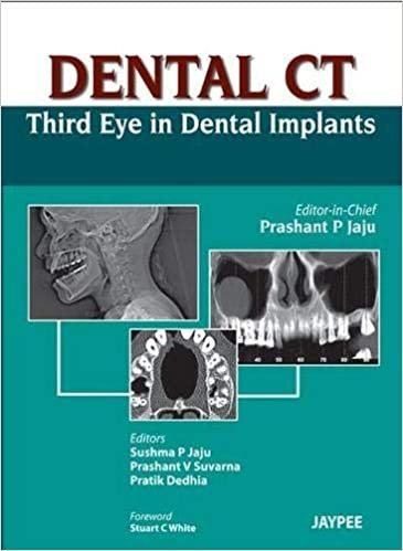 Dental CT Third Eye in Dental Implants