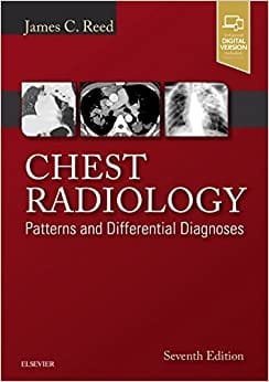 Chest Radiology Patterns and Differential Diagnoses 7th edition