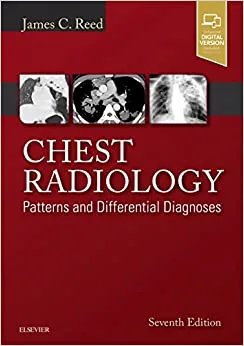 Chest Radiology Patterns and Differential Diagnoses 7th edition