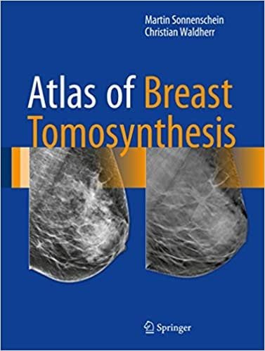Atlas of Breast Tomosynthesis Imaging Findings and Image Guided Interventions