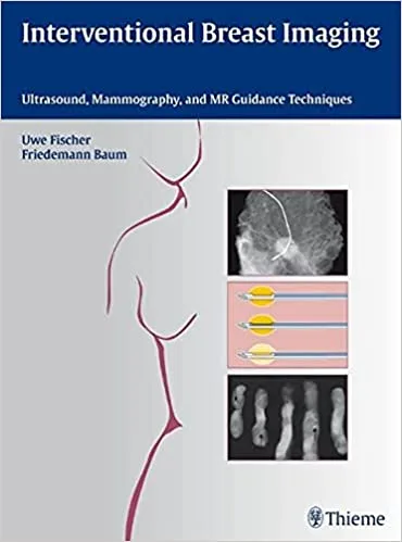 Interventional Breast Imaging Ultrasound Mammography and MR Guidance Techniques