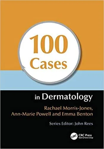 100 Cases In Dermatology 1st edition