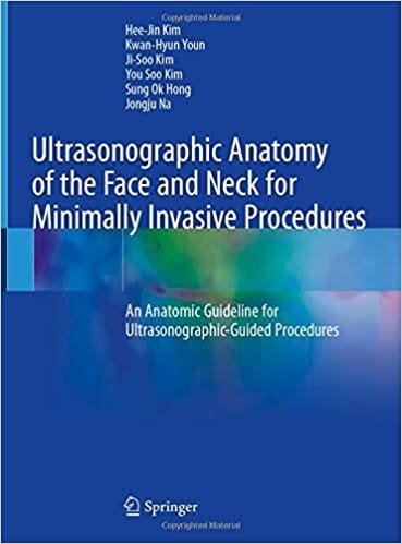 Ultrasonographic Anatomy of the Face and Neck for Minimally Invasive Procedures An Anatomic Guideline for Ultrasonographic Guided Procedures 1st edition