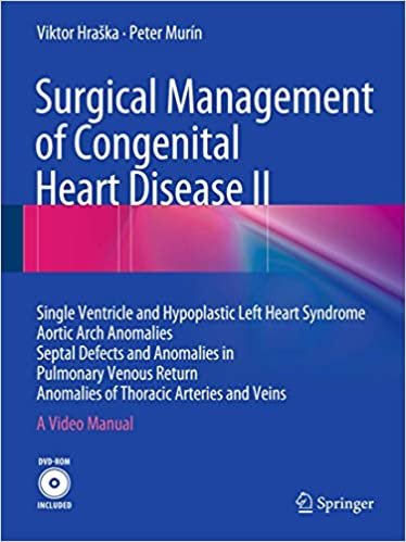 Surgical Management of Congenital Heart Disease II Single Ventricle and Hypoplastic Left Heart Syndrome Aortic Arch Anomalies Septal Defects and Of Thoracic Arteries and Veins A Video Manual