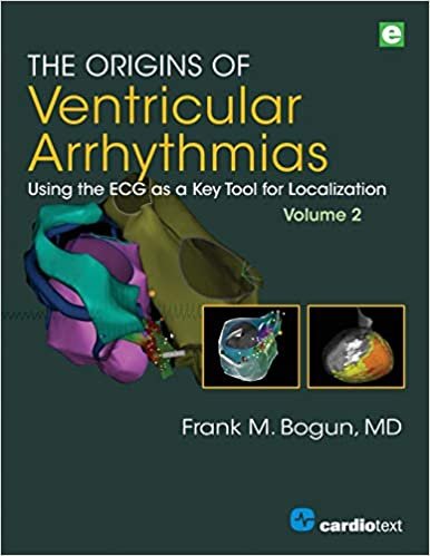 The Origins of Ventricular Arrhythmias Using the ECG as a Key Tool for Localization Volume 2