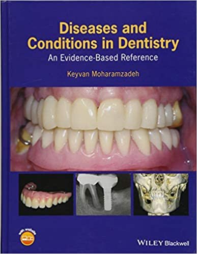 Diseases and Conditions in Dentistry An Evidence Based Reference 1st edition