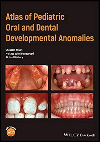Atlas of Pediatric Oral And Dental Developmental Anomalies 1st edition