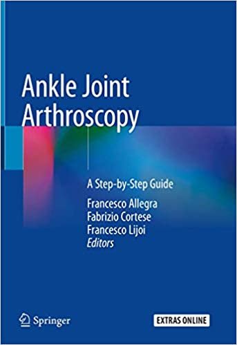 Ankle Joint Arthroscopy A Step by Step Guide