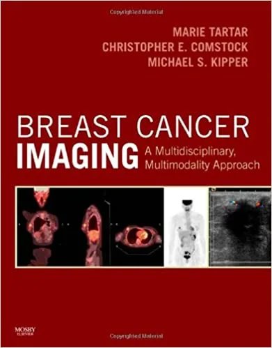 Breast Cancer Imaging A Multidisciplinary Multimodality Approach