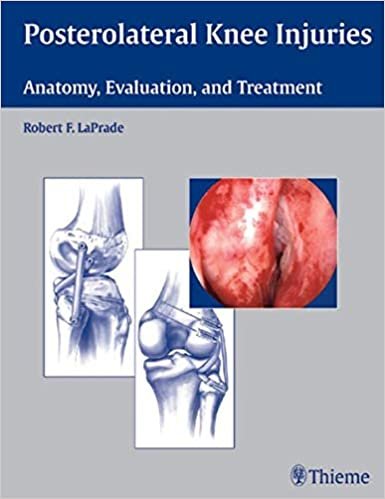 Posterolateral Knee Injuries Anatomy Evaluation and Treatment
