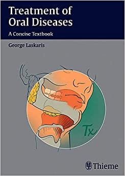 Treatment of Oral Diseases A Concise Textbook 1st edition