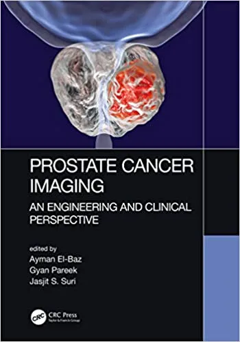 Prostate Cancer Imaging An Engineering and Clinical Perspective 1st edition