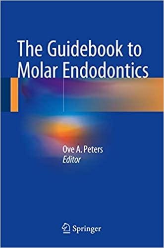 The Guidebook to Molar Endodontics 1st edition