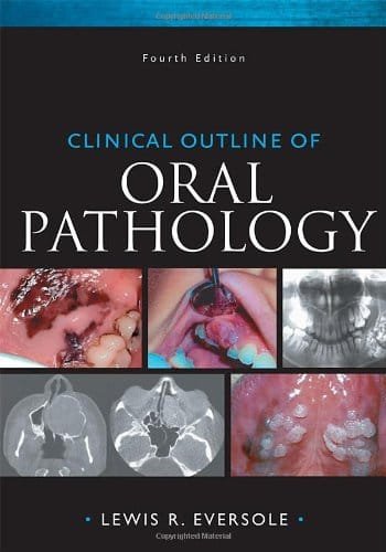 Clinical Outline of Oral Pathology Diagnosis and Treatment 4th edition