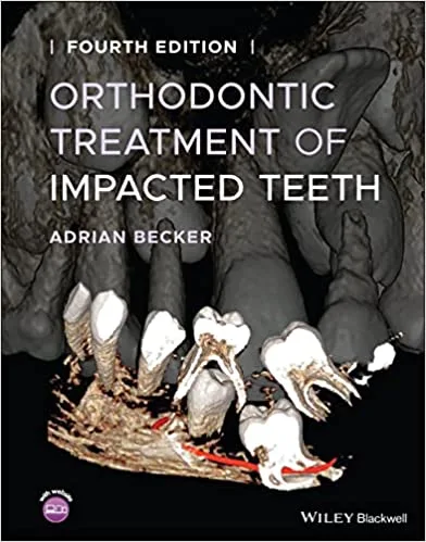Orthodontic Treatment of Impacted Teeth 4th edition