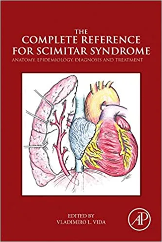 The Complete Reference for Scimitar Syndrome Anatomy Epidemiology Diagnosis and Treatment 1st edition